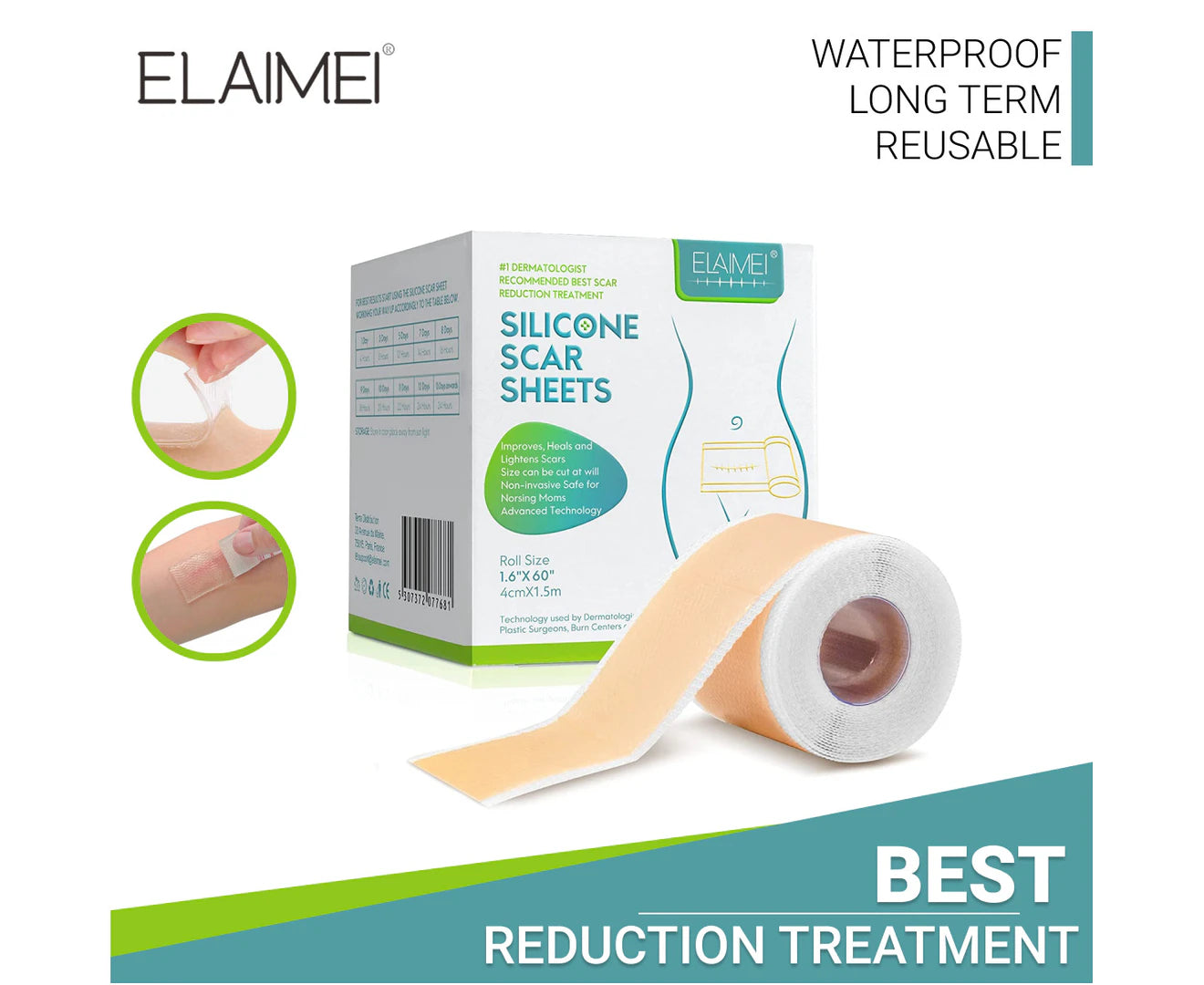 Silicone Gel Sheet Patch Scar Removal Tape Skin Repair Medical Treatment Remover Wound Keloid Surgery, 1.5M